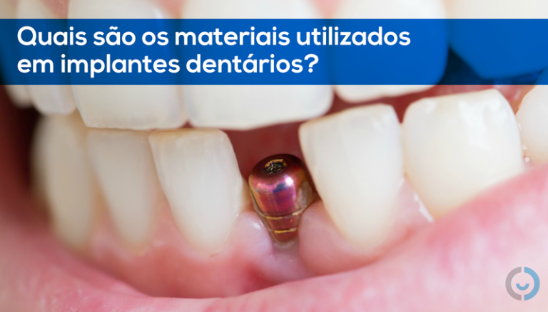 Conheça Os Tipos De Implantes Dentários E Descubra Qual é O Mais Indicado Para Você Coredent 3246